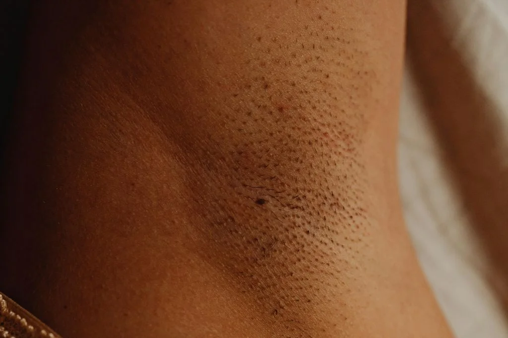 Read more about the article Ketiak Hitam, Buat Aku Tak Karuan